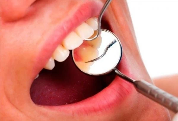 Αίμα στα ούλα: Τι συμβαίνει και ματώνουν; – Πώς το αντιμετωπίζουμε